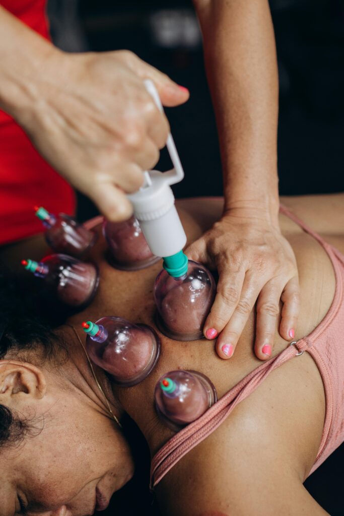pexels-photo-27730433-27730433 Close-up of cupping therapy on a woman's back, focusing on muscle recovery and relaxation.